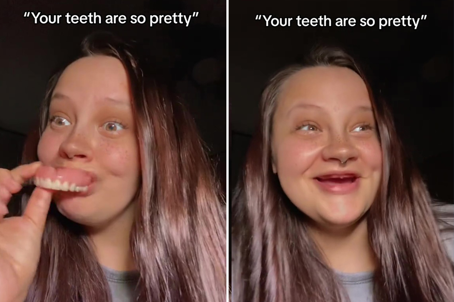 I'm a mom with dentures – I was ashamed, now I pop my teeth out for fun